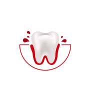 Hoe vaak bloedt je tandvlees tijdens het poetsen of flossen?