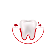 Hoe vaak bloedt je tandvlees tijdens het poetsen of flossen?