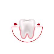 Hoe vaak bloedt je tandvlees tijdens het poetsen of flossen?